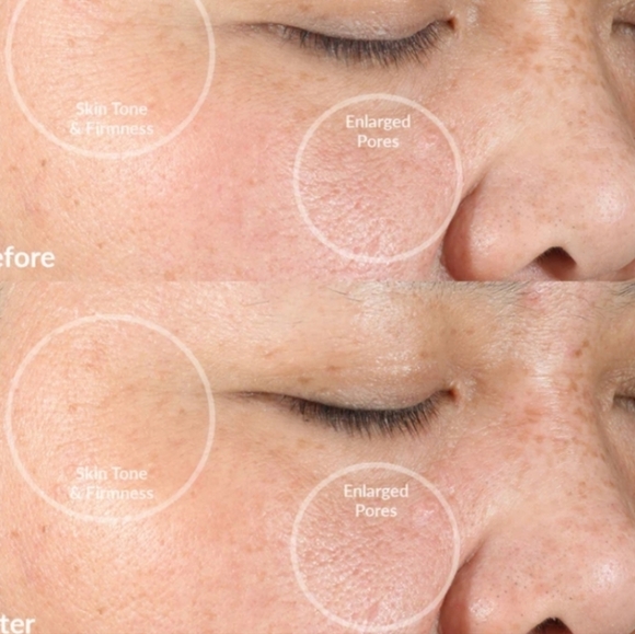 2/$100! PMD CLEAN SMART SONIC FACIAL CLEANSING BRUSH DEVICE SILICONE in BLUSH - Picture 8 of 11